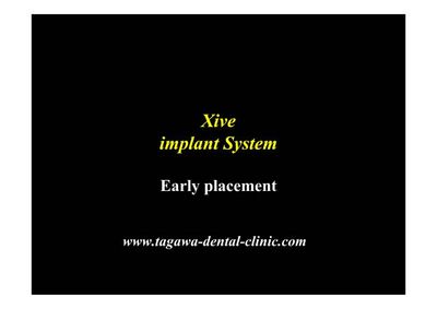 早期埋入の術前術後イメージ例1（田川歯科）